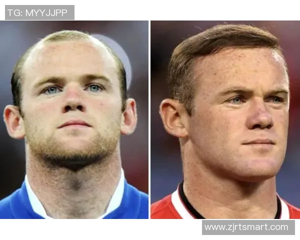 足球明星医美前后对比图赏析展现他们的魅力与自信之美 足球明星医美前后对比图赏析展现他们的魅力与自信之美